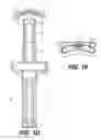 Fig. 04 - LUGGAGE HANDLE SYSTEM