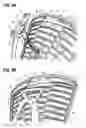 Fig. 07 - CHAIR