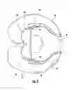 Fig. 03 - HEAD REST FOR SUPPORTING A PERSON'S HEAD WHEN RESTING IN A CHAIR