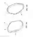 Fig. 08 - Cooking assembly comprising a flexible ring conformable to predeterminedly shaped templates of a cooking station for providing cooked foods with predeterminedly different shapes, and the cooking station employing the cooking assembly