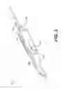 Fig. 04 - Methods and systems for attaching medical device sections