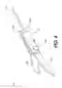 Fig. 05 - Methods and systems for attaching medical device sections