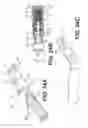 Fig. 25 - Methods and systems for attaching medical device sections