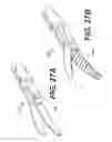 Fig. 29 - Methods and systems for attaching medical device sections