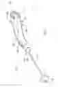 Fig. 02 - Method of performing a sphenopalatine ganglion block procedure