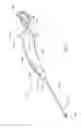 Fig. 03 - Method of performing a sphenopalatine ganglion block procedure