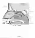 Fig. 10 - Method of performing a sphenopalatine ganglion block procedure
