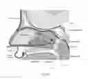 Fig. 13 - Method of performing a sphenopalatine ganglion block procedure