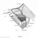 Fig. 20 - Method of performing a sphenopalatine ganglion block procedure