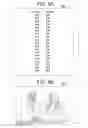 Fig. 09 - Means and method for demonstrating the effects of low cylinder astigmatism correction