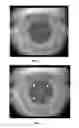 Fig. 04 - Methods for Objectively Determining the Visual Axis of the Eye and Measuring Its Refraction