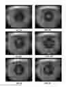 Fig. 08 - Methods for Objectively Determining the Visual Axis of the Eye and Measuring Its Refraction