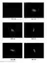 Fig. 09 - Methods for Objectively Determining the Visual Axis of the Eye and Measuring Its Refraction