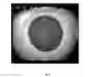 Fig. 10 - Methods for Objectively Determining the Visual Axis of the Eye and Measuring Its Refraction