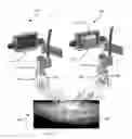 Fig. 01 - VEIN IMAGING SYSTEMS AND METHODS