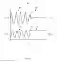 Fig. 23 - Methods and systems for power optimization in a medical device