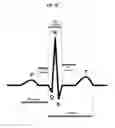 Fig. 05 - Techniques for Predicting Cardiac Arrhythmias Based on Signals from Leads of Electrocardiography