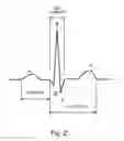 Fig. 03 - QT interval determination methods and related devices