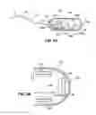 Fig. 04 - Optical capsule and spectroscopic method for treating and diagnosing the intestinal tract