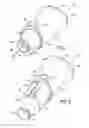 Fig. 02 - Safety blood collection assembly with indicator