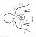 Fig. 03 - COMBINATION THERAPY FOR SLEEP DISORDERED BREATHING AND HEART FAILURE