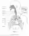 Fig. 05 - COMBINATION THERAPY FOR SLEEP DISORDERED BREATHING AND HEART FAILURE