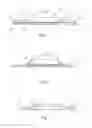 Fig. 02 - Skin-mountable medical device