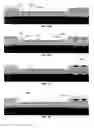 Fig. 14 - Integrated multimodal sensor device for intracranial neuromonitoring