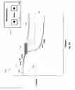 Fig. 16 - Percutaneous coronary intervention (PCI) planning interface with pressure data and vessel data and associated devices, systems, and methods