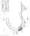 Fig. 17 - Percutaneous coronary intervention (PCI) planning interface with pressure data and vessel data and associated devices, systems, and methods