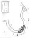 Fig. 23 - Percutaneous coronary intervention (PCI) planning interface with pressure data and vessel data and associated devices, systems, and methods