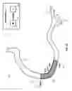 Fig. 25 - Percutaneous coronary intervention (PCI) planning interface with pressure data and vessel data and associated devices, systems, and methods
