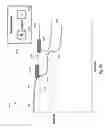 Fig. 28 - Percutaneous coronary intervention (PCI) planning interface with pressure data and vessel data and associated devices, systems, and methods