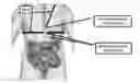 Fig. 01 - Personalized detection system for detecting magnetic objects in the human organism