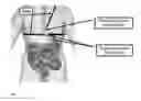 Fig. 02 - Personalized detection system for detecting magnetic objects in the human organism