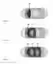 Fig. 04 - Personalized detection system for detecting magnetic objects in the human organism