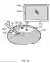 Fig. 06 - Systems for localization of targets inside a body
