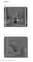 Fig. 02 - METHOD AND SYSTEM FOR INTRAOPERATIVE IMAGING OF SOFT TISSUE IN THE DORSAL CAVITY