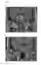 Fig. 03 - METHOD AND SYSTEM FOR INTRAOPERATIVE IMAGING OF SOFT TISSUE IN THE DORSAL CAVITY