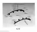 Fig. 08 - Detector apparatus for cone beam computed tomography