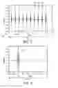 Fig. 04 - Acoustic highlighting of interventional instruments