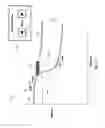 Fig. 16 - Percutaneous coronary intervention (PCI) planning interface and associated devices, systems, and methods