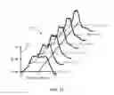 Fig. 07 - Systems and methods for ultrasound motion display and analysis