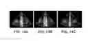Fig. 10 - Systems and methods for ultrasound motion display and analysis