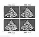Fig. 13 - Systems and methods for ultrasound motion display and analysis