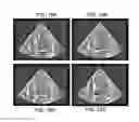 Fig. 14 - Systems and methods for ultrasound motion display and analysis