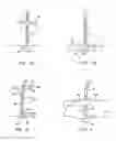 Fig. 03 - Medical device for wound closure and method of use