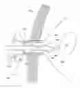 Fig. 01 - SURGICAL CAPTURE DEVICE AND METHODS OF USE