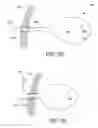 Fig. 13 - SURGICAL CAPTURE DEVICE AND METHODS OF USE