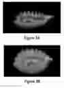 Fig. 06 - Soft robotic retractors